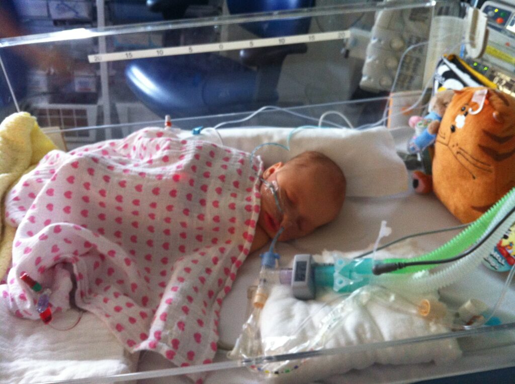 my daughter spent the third week of life in an induced coma – UK Health Security Agency